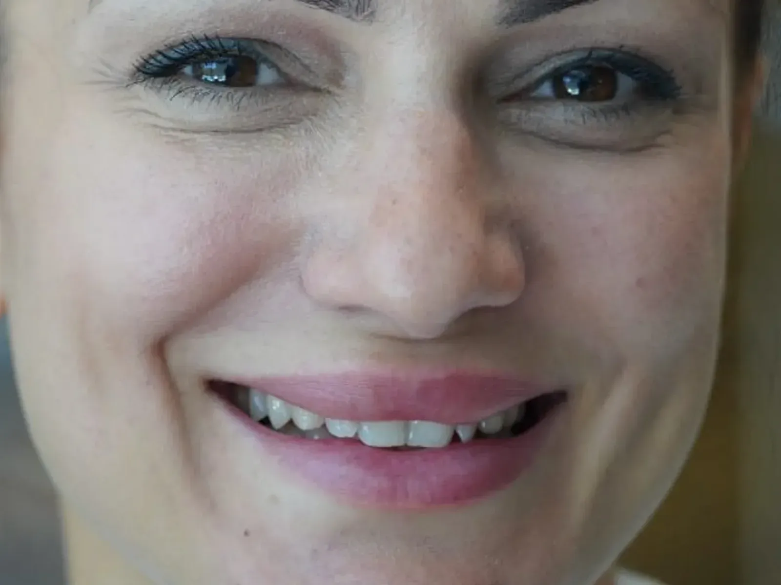 Przed implanty zębowe — przypadek z naszej kliniki